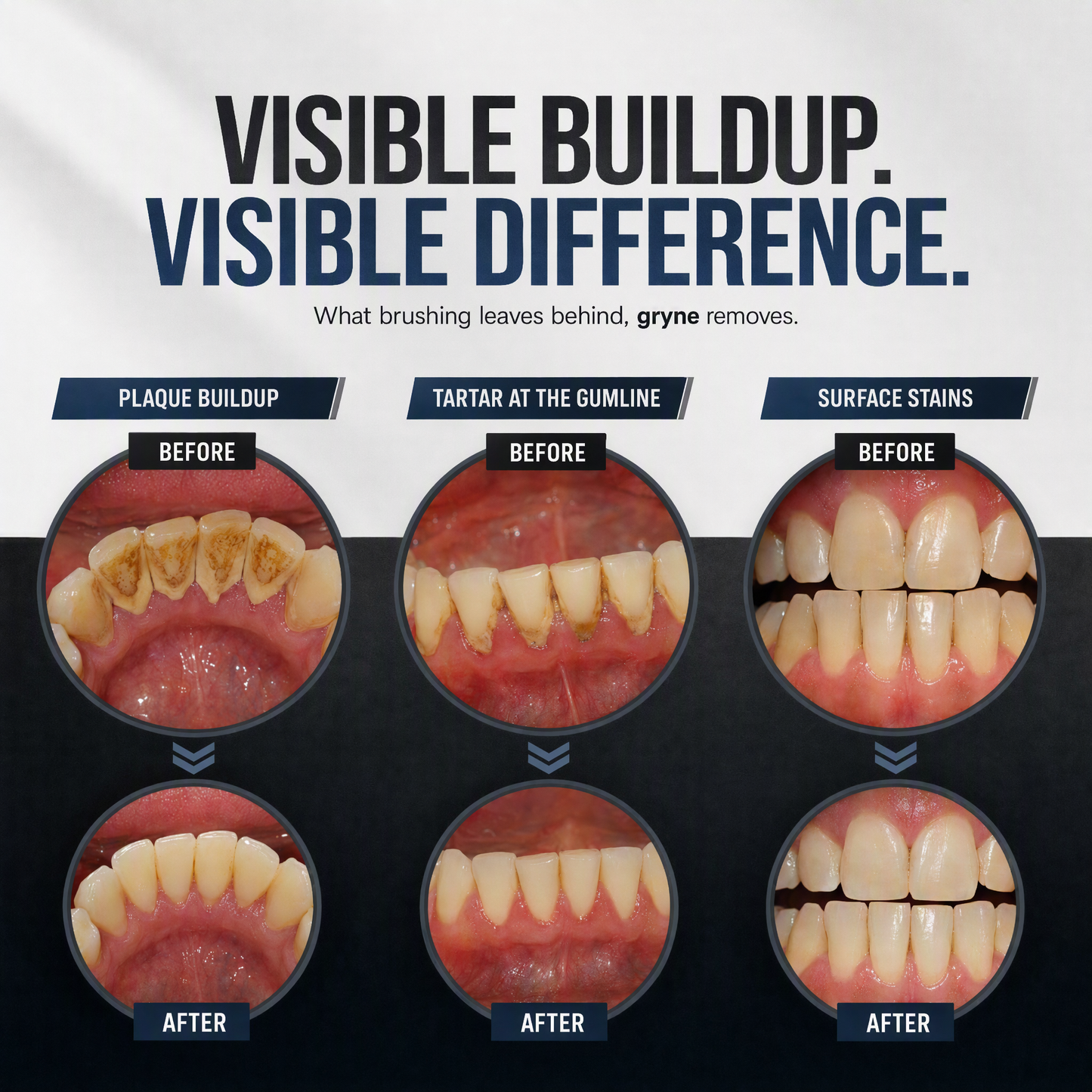 OralTech Pro