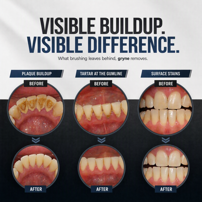 OralTech Pro